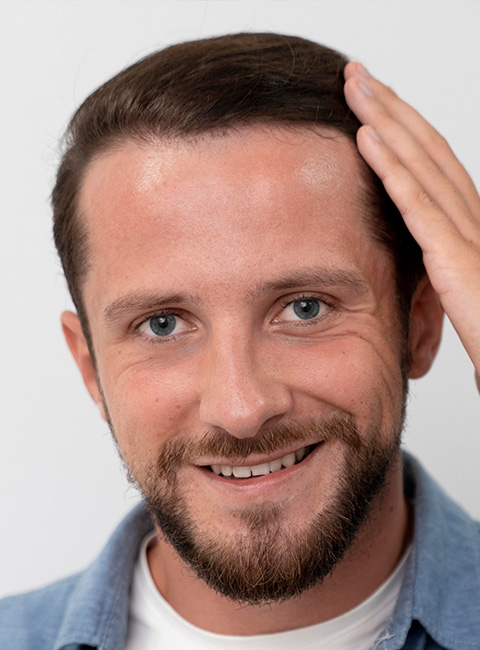 عمليات-إصلاح-زراعة-الشعر